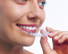 Aligner